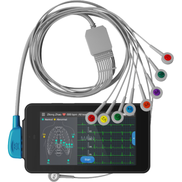 Electrocardiographe de poche Pocket ECG 500 Lepu Médical avec interprétation