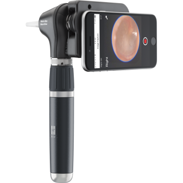 Otoscope LED Welch Allyn Macroview 2 Plus iExaminer