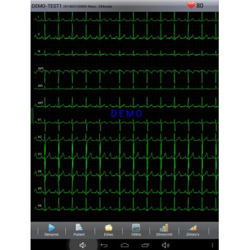 Electrocardiographe ECG Edan PADECG Numérique sans fil avec interprétation pour tablette Android