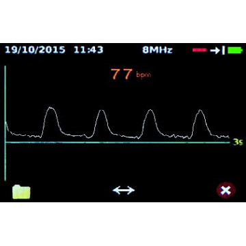 Doppler de poche bidirectionnel Dopplex DMX (avec sonde 4, 5, 8 ou 10 Mhz)