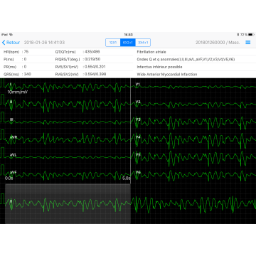 Electrocardiographe ECG Edan PADECG Numérique sans fil pour iPad avec interprétation